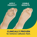 Callus Removers Seal & Heal Bandage with Hydrogel Technology